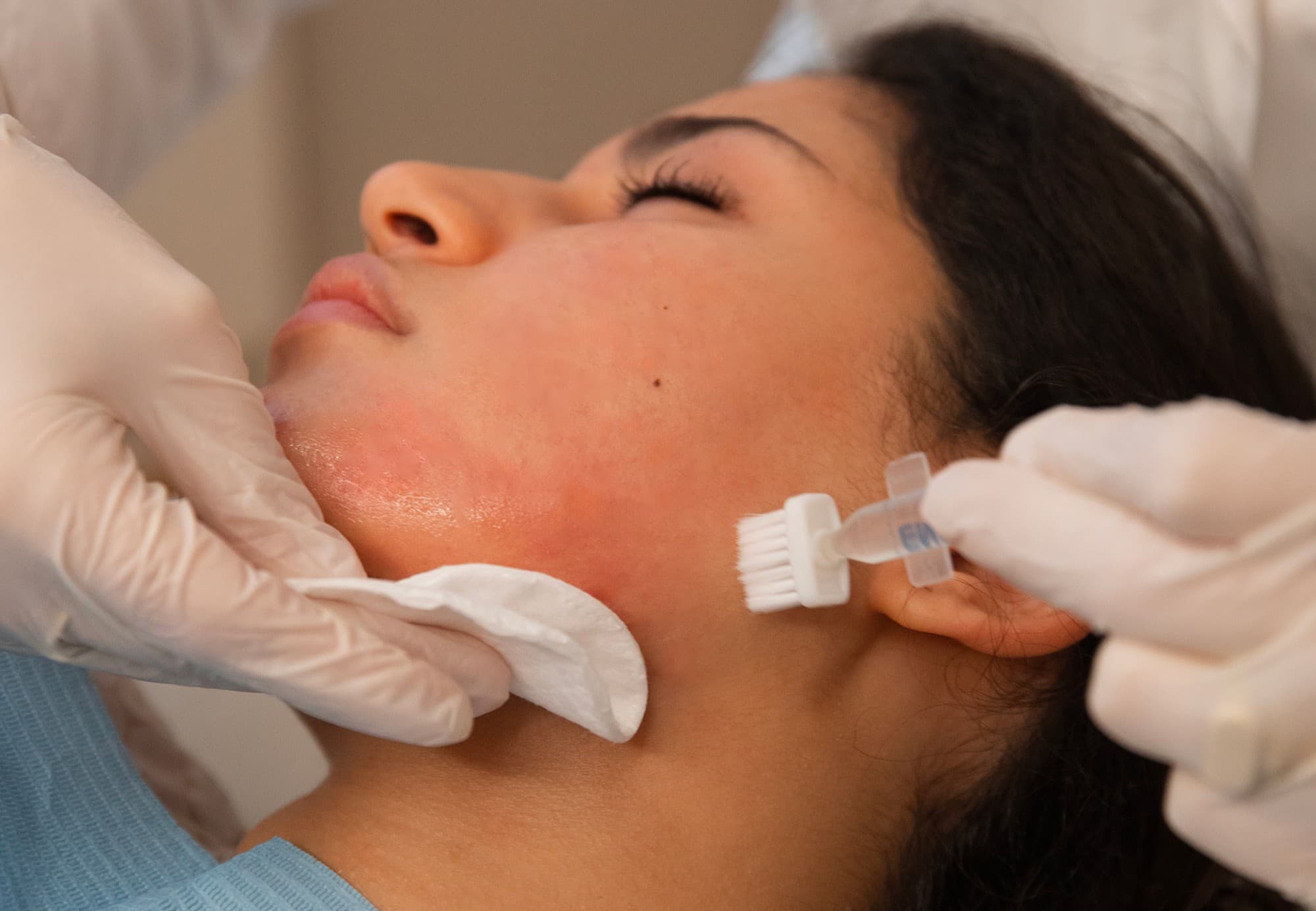 come-ringiovanire-la-pelle-del-viso