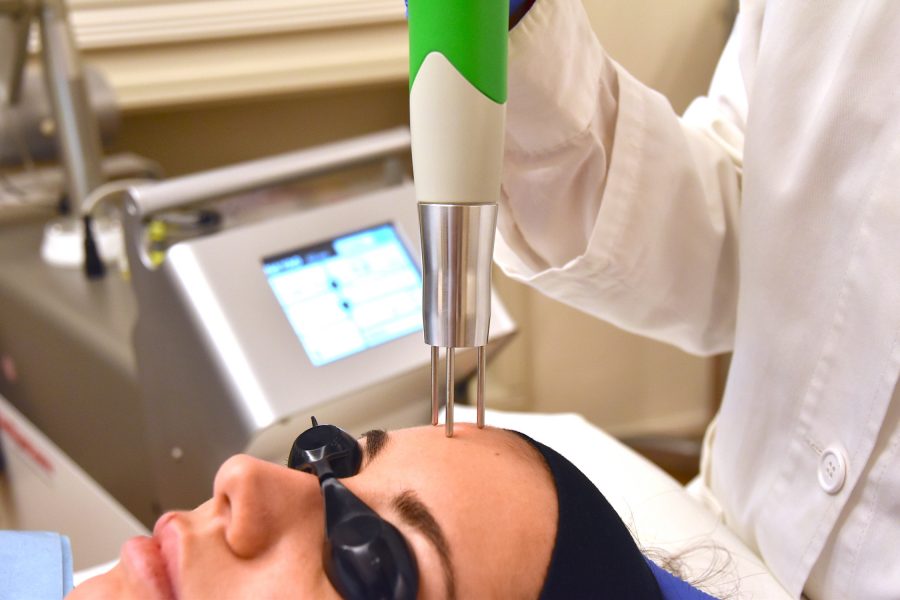 Rimuovere le macchie della pelle con il laser Q-Switched